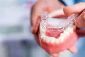 clear aligners in Sacramento