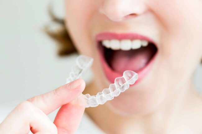 clear aligners in Sacramento