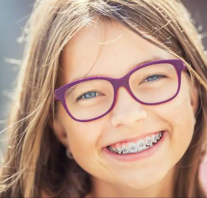 affordable braces Roseville