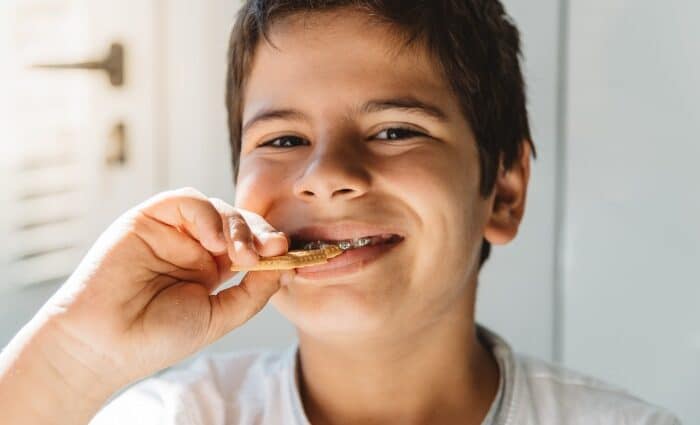 Soft Food Diet for Braces