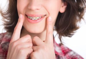 soft foods to eat with braces