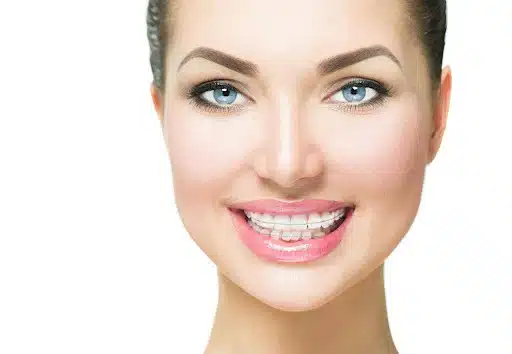 Patient smiling confidently with less noticeable braces