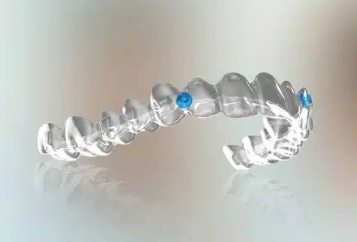 Angel Aligner vs Invisalign side-by-side comparison